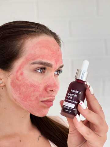 Hollyskin Acid Peeling Face Serum, 30 mL - Image 4