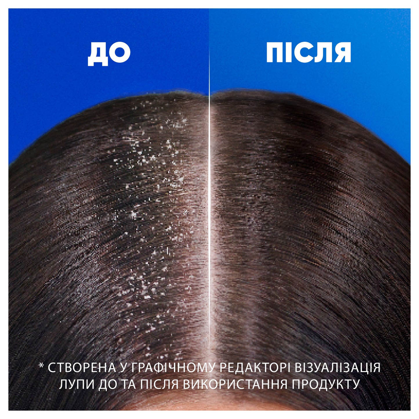 Head & Shoulders Smooth & Silky Anti-Dandruff Shampoo, 250 mL - Image 3