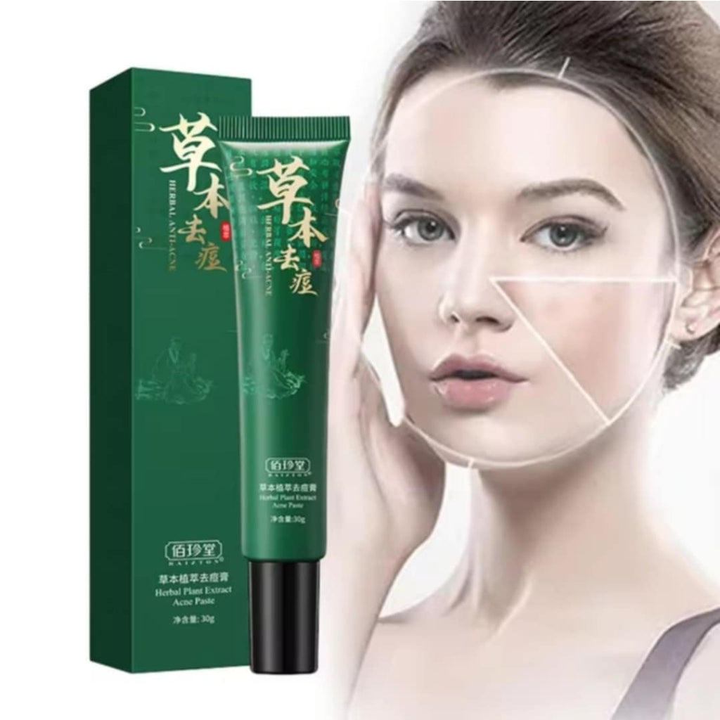 Baizton Centella Asiatica Anti-Acne Face Cream, 30 g - Image 2