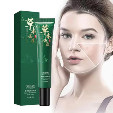 Baizton Centella Asiatica Anti-Acne Face Cream, 30 g - Image 2
