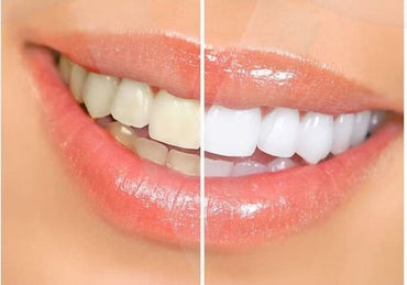 Elkos DentaMax White Toothpaste, 125 mL - Image 2