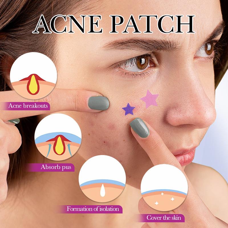 Sadoer Spot Acne Patches, 78 Pieces - Image 2