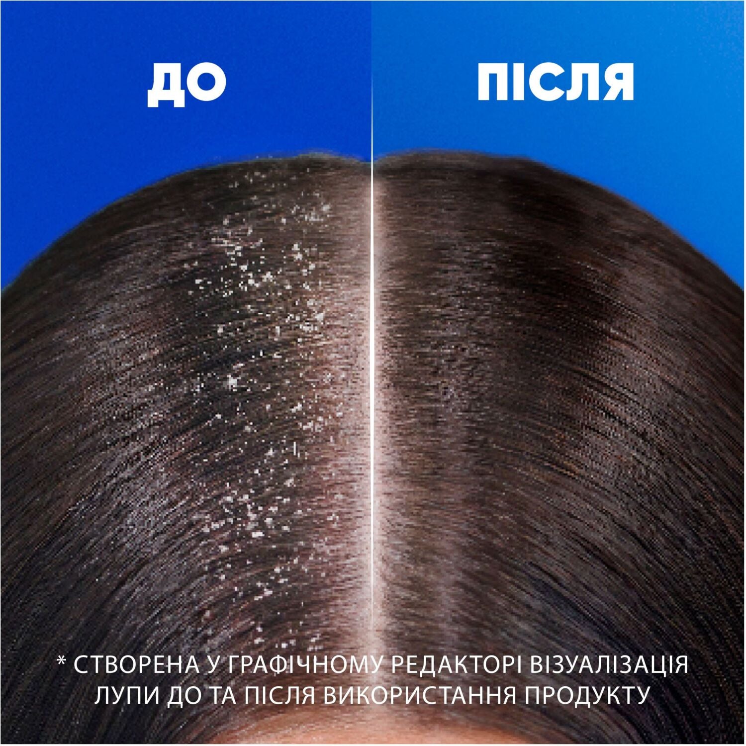 Head & Shoulders Basic Care 2-in-1 Shampoo, 330 mL - Image 3