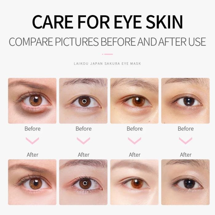 Laikou Japan Sakura Hydrogel Under-Eye Mask Patches, 50 pcs - Image 3